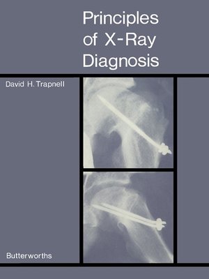 cover image of Principles of X-Ray Diagnosis